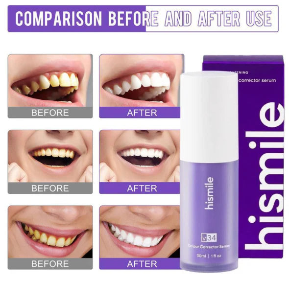 Hismile Toothpaste
